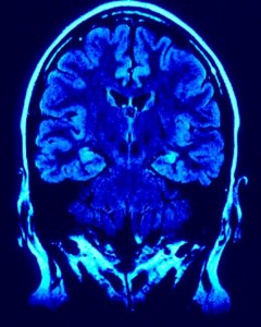 Disability For MS, Multiple Sclerosis